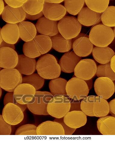 Stock Photo - Coloured scanning electron micrograph (SEM) of Staphylococcus warneri, coccoid, Gram-positive prokaryote. Staphylococcus warneri is a common commensal bacterium found on the skin of humans and animals. It is a coagulase-negative Staphylococcus sp..... Fotosearch