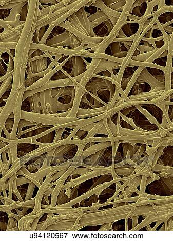 Coloured scanning electron micrograph (SEM) Chicken eggshell inner membrane (Gallus gallus domesticus). Shown here is the eggshell inner membrane that is composed of protein fibres (internal and attached to the hard eggshell). Several membranes are... View Large Photo Image Stock Photo - Coloured scanning electron micrograph (SEM) Chicken eggshell inner membrane (Gallus gallus domesticus). Shown here is the eggshell inner membrane that is composed of protein fibres (internal and attached to the hard eggshell). Several membranes are.... Fotosearch