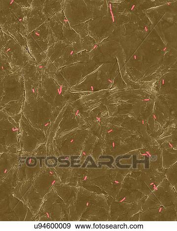 Stock Photo - Coloured scanning electron micrograph (SEM) of Photocomposite, E. coli on the surface of human skin. Escherichia coli, Gram-negative, facultatively anaerobic, rod prokaryote. E. coli is part of human and animal microbiota. It can cause urinary tract.... Fotosearch