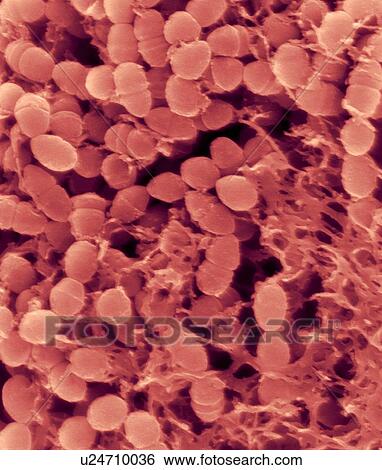 Stock Photograph - Coloured scanning electron micrograph (SEM) of Oral bacterium, Streptococcus mutans with surrounding dextran polysaccharide mucilage (glucan). S. mutans is a coccoid shaped, Gram-positive, facultative anaerobic bacterium that is part of the normal.... Fotosearch
