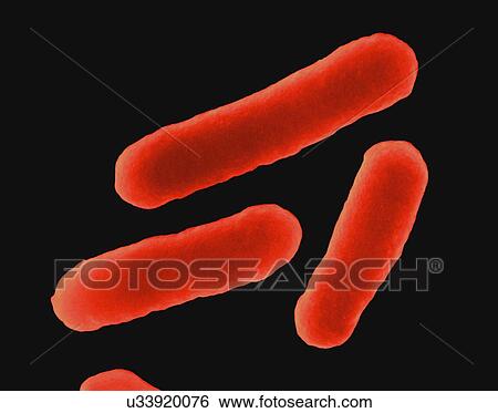 Coloured scanning electron micrograph (SEM) of E. coli (Escherichia coli), dividing, haemorrhagic 0157: H7 strain. Escherichia coli is a Gram-negative, facultatively anaerobic, enteric, rod prokaryote. This bacterium was isolated from the human... View Large Photo Image Stock Photograph - Coloured scanning electron micrograph (SEM) of E. coli (Escherichia coli), dividing, haemorrhagic 0157: H7 strain. Escherichia coli is a Gram-negative, facultatively anaerobic, enteric, rod prokaryote. This bacterium was isolated from the human.... Fotosearch