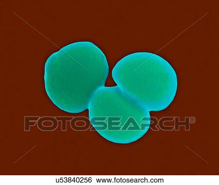 Coloured scanning electron micrograph (SEM) of Staphylococcus aureus, Gram-positive, MRSA, coccus prokaryote (dividing); causes food poisoning, toxic shock syndrome and skin and wound infections such as scalded skin syndrome, scarlet fever, erysipelas... View Large Photo Image Stock Photograph - Coloured scanning electron micrograph (SEM) of Staphylococcus aureus, Gram-positive, MRSA, coccus prokaryote (dividing); causes food poisoning, toxic shock syndrome and skin and wound infections such as scalded skin syndrome, scarlet fever, erysipelas.... Fotosearch