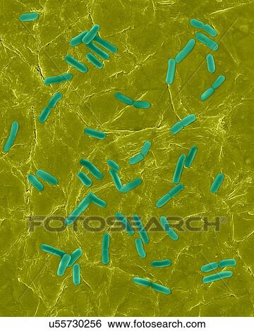 Stock Photograph - Coloured scanning electron micrograph (SEM) of Photocomposite, E. coli on the surface of human skin. Escherichia coli is a Gram-negative, facultatively anaerobic, enteric, rod prokaryote. This bacterium is normally a part of the human and animal.... Fotosearch