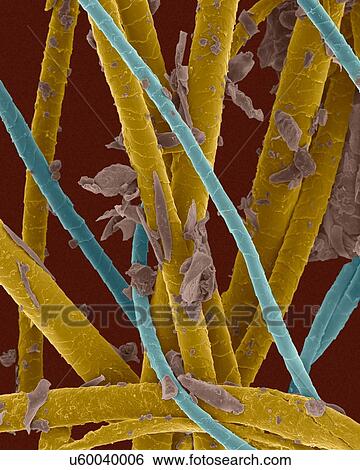 Stock Photograph - Coloured scanning electron micrograph (SEM) Pet dander. dog hair, cat hair and dead skin (cat hair. blue, dog hair. dark yellow, dander. purple). Dog and cats produce human allergens. Pet dander is the material shed from the body of various animals.... Fotosearch