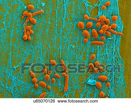 Coloured scanning electron micrograph (SEM) of Candida albicans infected medical catheter. A common yeast, C. albicans can colonize catheters resulting in serious tissue infections. Shown here is the inner surface of an infected catheter (removed from... View Large Photo Image Stock Photograph - Coloured scanning electron micrograph (SEM) of Candida albicans infected medical catheter. A common yeast, C. albicans can colonize catheters resulting in serious tissue infections. Shown here is the inner surface of an infected catheter (removed from.... Fotosearch