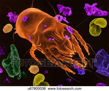 Stock Photograph - Coloured scanning electron micrograph (SEM) of Dust mite (Dermatophagoides pteronyssinus) with dust mite faecal pellets (light brown), pollen (yellow), mineral (blue), plant debris (green), and dead skin/dander (purple). Millions of dust mites inhabit.... Fotosearch
