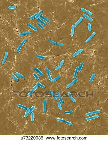 Coloured scanning electron micrograph (SEM) of Photocomposite, E. coli on the surface of human skin. Escherichia coli is a Gram-negative, facultatively anaerobic, enteric, rod prokaryote. This bacterium is normally a part of the human and animal... View Large Photo Image Stock Photograph - Coloured scanning electron micrograph (SEM) of Photocomposite, E. coli on the surface of human skin. Escherichia coli is a Gram-negative, facultatively anaerobic, enteric, rod prokaryote. This bacterium is normally a part of the human and animal.... Fotosearch