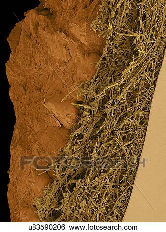 Coloured scanning electron micrograph (SEM) Chicken eggshell cross section (Gallus gallus domesticus). Shown from left to right in the image. hard mineralized eggshell, internal fibrous membrane and smooth inner surface of the internal membrane. The... View Large Photo Image Stock Photograph - Coloured scanning electron micrograph (SEM) Chicken eggshell cross section (Gallus gallus domesticus). Shown from left to right in the image. hard mineralized eggshell, internal fibrous membrane and smooth inner surface of the internal membrane. The.... Fotosearch