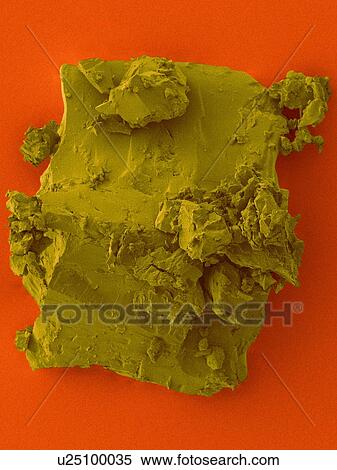 Coloured scanning electron micrograph (SEM) of Coal from the ship Titanic. Coal is a fossil fuel (combustible sedimentary rock) that forms when dead plant matter is converted into peat. Over time geological processes convert peat into lignite, then... View Large Photo Image Stock Photography - Coloured scanning electron micrograph (SEM) of Coal from the ship Titanic. Coal is a fossil fuel (combustible sedimentary rock) that forms when dead plant matter is converted into peat. Over time geological processes convert peat into lignite, then.... Fotosearch
