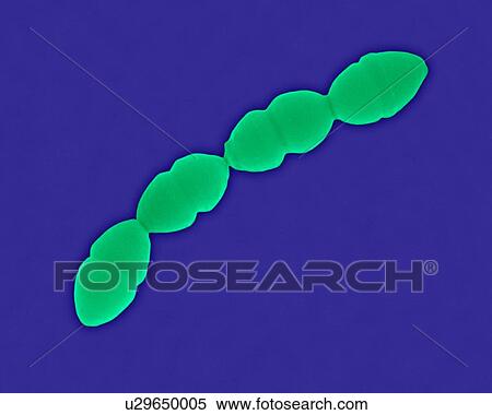 Coloured scanning electron micrograph (SEM) of Streptococcus pneumoniae, Gram-positive, encapsulated, coccus prokaryote (dividing). Causes (lower respiratory infection) pneumonia and (upper respiratory infections) bronchitis, laryngitis, sinusitis,... View Large Photo Image Stock Photography - Coloured scanning electron micrograph (SEM) of Streptococcus pneumoniae, Gram-positive, encapsulated, coccus prokaryote (dividing). Causes (lower respiratory infection) pneumonia and (upper respiratory infections) bronchitis, laryngitis, sinusitis,.... Fotosearch