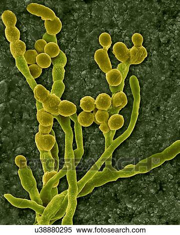 Coloured scanning electron micrograph (SEM) of the common environmental and allergenic mould (Cladosporium sp. ); fungal hyphae producing spores. Also known as Hormodendrum sp. This specimen was found on the inner surface of a building's air supply... View Large Photo Image Stock Photography - Coloured scanning electron micrograph (SEM) of the common environmental and allergenic mould (Cladosporium sp. ); fungal hyphae producing spores. Also known as Hormodendrum sp. This specimen was found on the inner surface of a building's air supply.... Fotosearch