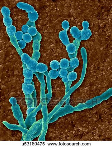 Coloured scanning electron micrograph (SEM) of the common environmental and allergenic mould (Cladosporium sp. ); fungal hyphae producing spores. Also known as Hormodendrum sp. This specimen was found on the inner surface of a building's air supply... View Large Photo Image Stock Photography - Coloured scanning electron micrograph (SEM) of the common environmental and allergenic mould (Cladosporium sp. ); fungal hyphae producing spores. Also known as Hormodendrum sp. This specimen was found on the inner surface of a building's air supply.... Fotosearch