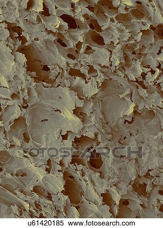 Stock Photography - Coloured scanning electron micrograph (SEM) of White bread surface. Shown here is a slice of white sandwich bread, revealing the large airspaces that develop as a result of the action of the yeast. White bread made from wheat flour that has the bran.... Fotosearch