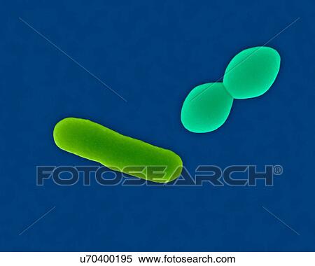 Stock Photography - Coloured scanning electron micrograph (SEM) of Streptococcus pneumoniae, Gram-positive, encapsulated, coccus prokaryote (dividing). Causes (lower respiratory infection) pneumonia and (upper respiratory infections) bronchitis, laryngitis, otitis media.... Fotosearch