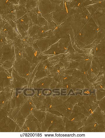 Coloured scanning electron micrograph (SEM) of Photocomposite, E. coli on the surface of human skin. Escherichia coli, Gram-negative, facultatively anaerobic, rod prokaryote. E. coli is part of human and animal microbiota. It can cause urinary tract... View Large Photo Image Stock Photography - Coloured scanning electron micrograph (SEM) of Photocomposite, E. coli on the surface of human skin. Escherichia coli, Gram-negative, facultatively anaerobic, rod prokaryote. E. coli is part of human and animal microbiota. It can cause urinary tract.... Fotosearch