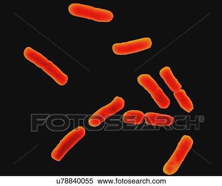 Coloured scanning electron micrograph (SEM) of Escherichia coli is a Gram-negative, facultatively anaerobic, enteric, rod prokaryote. This bacterium was isolated from the human intestine and is normally a part of the human and animal microbiota. Most... View Large Photo Image Stock Photography - Coloured scanning electron micrograph (SEM) of Escherichia coli is a Gram-negative, facultatively anaerobic, enteric, rod prokaryote. This bacterium was isolated from the human intestine and is normally a part of the human and animal microbiota. Most.... Fotosearch