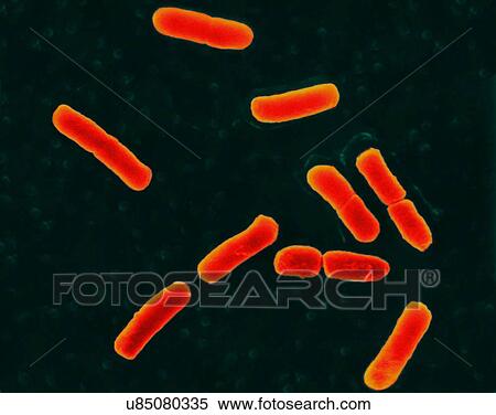 Coloured scanning electron micrograph (SEM) of Escherichia coli is a Gram-negative, facultatively anaerobic, enteric, rod prokaryote. This bacterium was isolated from the human intestine and is normally a part of the human and animal microbiota. Most... View Large Photo Image Stock Photography - Coloured scanning electron micrograph (SEM) of Escherichia coli is a Gram-negative, facultatively anaerobic, enteric, rod prokaryote. This bacterium was isolated from the human intestine and is normally a part of the human and animal microbiota. Most.... Fotosearch