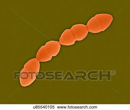 Coloured scanning electron micrograph (SEM) of Streptococcus pneumoniae, Gram-positive, encapsulated, coccus prokaryote (dividing). Causes (lower respiratory infection) pneumonia and (upper respiratory infections) bronchitis, laryngitis, sinusitis,... View Large Photo Image Stock Photography - Coloured scanning electron micrograph (SEM) of Streptococcus pneumoniae, Gram-positive, encapsulated, coccus prokaryote (dividing). Causes (lower respiratory infection) pneumonia and (upper respiratory infections) bronchitis, laryngitis, sinusitis,.... Fotosearch
