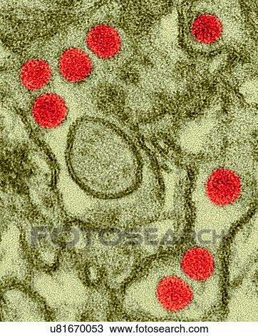 Coloured transmission electron micrograph (TEM) of Zika virus particles (red) isolated in kidney epithelial cells (Vero E6 cells). Zika viruses have a dense core surrounded by an envelope (40nm size). Zika virus is a RNA (ribonucleic acid) virus in... View Large Photo Image Stock Image - Coloured transmission electron micrograph (TEM) of Zika virus particles (red) isolated in kidney epithelial cells (Vero E6 cells). Zika viruses have a dense core surrounded by an envelope (40nm size). Zika virus is a RNA (ribonucleic acid) virus in.... Fotosearch