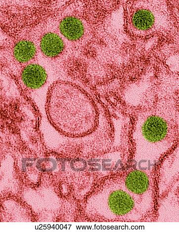 Stock Photo - Coloured transmission electron micrograph (TEM) of Zika virus particles (green) isolated in kidney epithelial cells (Vero E6 cells). Zika viruses have a dense core surrounded by an envelope (40nm size). Zika virus is a RNA (ribonucleic acid) virus in.... Fotosearch