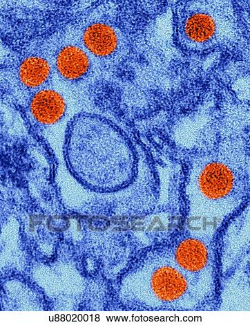 Stock Photo - Coloured transmission electron micrograph (TEM) of Zika virus particles (orange) isolated in kidney epithelial cells (Vero E6 cells). Zika viruses have a dense core surrounded by an envelope (40nm size). Zika virus is a RNA (ribonucleic acid) virus in.... Fotosearch