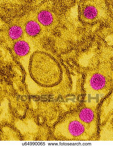 Stock Photography - Coloured transmission electron micrograph (TEM) of Zika virus particles (pink) isolated in kidney epithelial cells (Vero E6 cells). Zika viruses have a dense core surrounded by an envelope (40nm size). Zika virus is a RNA (ribonucleic acid) virus in.... Fotosearch
