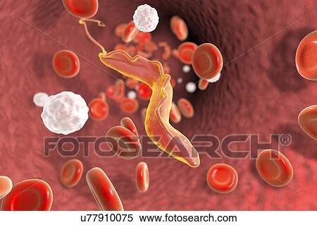 Computer illustration of a trypanosome (Trypanosoma cruzi) which causes Chagas' disease (American trypanosomiasis). It is a vector-borne parasite transmitted by assassin bug, also known as kissing bug (order Hemiptera, sub-family Triatominae). These... View Large Photo Image Stock Photography - Computer illustration of a trypanosome (Trypanosoma cruzi) which causes Chagas' disease (American trypanosomiasis). It is a vector-borne parasite transmitted by assassin bug, also known as kissing bug (order Hemiptera, sub-family Triatominae). These.... Fotosearch