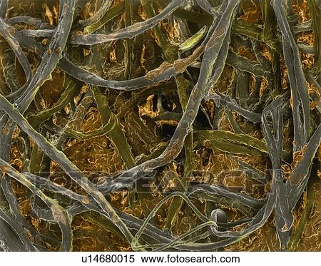 Cotton bud with ear wax embedded in fibres, coloured scanning electron micrograph (SEM). A cotton bud is a small stick with a cotton swab at one or both ends. It is used as a cleaning tool for ears but has many other uses including beauty, cosmetics,... View Large Photo Image Stock Photography - Cotton bud with ear wax embedded in fibres, coloured scanning electron micrograph (SEM). A cotton bud is a small stick with a cotton swab at one or both ends. It is used as a cleaning tool for ears but has many other uses including beauty, cosmetics,.... Fotosearch