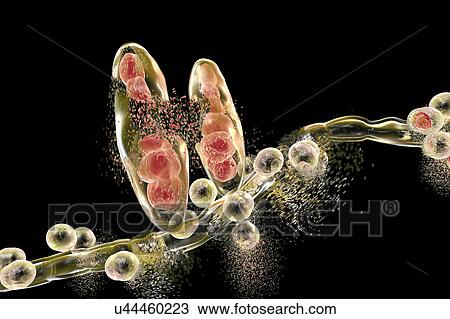 Stock Image - Destruction of athlete's foot fungus Trichophyton mentagrophytes, computer illustration. Conceptual image for Athlete's foot treatment and prevention. T. mentagrophytes is the cause of athlete's foot (tinea pedis) and scalp ringworm (tinea capitus)..... Fotosearch