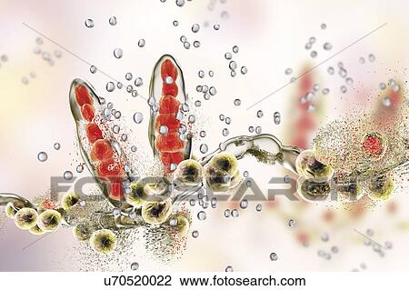 Stock Image - Destruction of athlete's foot fungus Trichophyton mentagrophytes by nanoparticles, computer illustration. Conceptual image for Athlete's foot treatment and prevention showing antifungal application of nanoparticles. T. mentagrophytes is the cause of.... Fotosearch