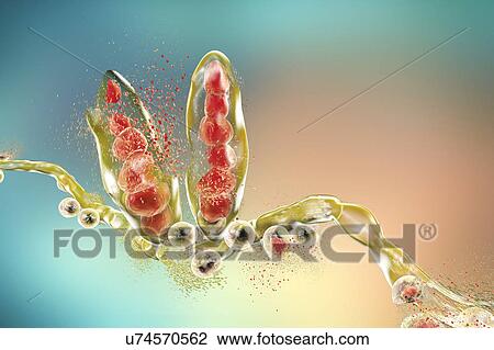 Stock Image - Destruction of athlete's foot fungus Trichophyton mentagrophytes, computer illustration. Conceptual image for Athlete's foot treatment and prevention. T. mentagrophytes is the cause of athlete's foot (tinea pedis) and scalp ringworm (tinea capitus)..... Fotosearch