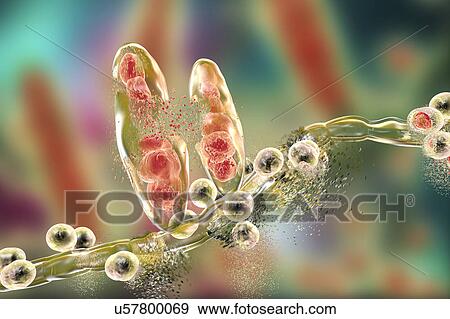Stock Photo - Destruction of athlete's foot fungus Trichophyton mentagrophytes, computer illustration. Conceptual image for Athlete's foot treatment and prevention. T. mentagrophytes is the cause of athlete's foot (tinea pedis) and scalp ringworm (tinea capitus)..... Fotosearch