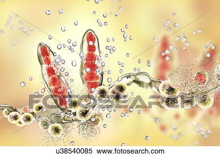 Stock Photography - Destruction of athlete's foot fungus Trichophyton mentagrophytes by nanoparticles, computer illustration. Conceptual image for Athlete's foot treatment and prevention showing antifungal application of nanoparticles. T. mentagrophytes is the cause of.... Fotosearch