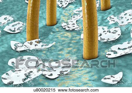 Stock Photography - Destruction of dandruff, computer illustration. Conceptual image for dandruff treatment.. Fotosearch