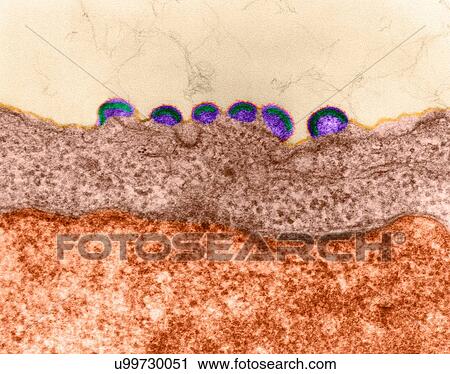 Stock Image - HIV infection, coloured transmission electron micrograph (TEM). Mature virus and budding release of HIV in human lymph tissue (RNA virus, Retroviridae Family). In retroviruses the nucleocapsid buds directly through the cytoplasmic membrane. This.... Fotosearch