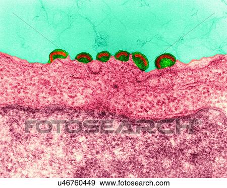 Stock Photo - HIV infection, coloured transmission electron micrograph (TEM). Mature virus and budding release of HIV in human lymph tissue (RNA virus, Retroviridae Family). In retroviruses the nucleocapsid buds directly through the cytoplasmic membrane. This.... Fotosearch