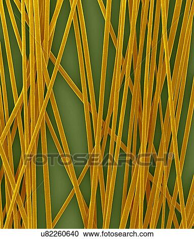 Stock Image - Human hair shafts from the head, coloured scanning electron micrograph (SEM). The outer layer of hair (the cuticle) has overlapping scales of keratin. These scales are thought to prevent hairs from matting together. Hair is made up of a fibrous.... Fotosearch