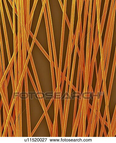 Human hair shafts from the head, coloured scanning electron micrograph (SEM). The outer layer of hair (the cuticle) has overlapping scales of keratin. These scales are thought to prevent hairs from matting together. Hair is made up of a fibrous... View Large Photo Image Stock Photo - Human hair shafts from the head, coloured scanning electron micrograph (SEM). The outer layer of hair (the cuticle) has overlapping scales of keratin. These scales are thought to prevent hairs from matting together. Hair is made up of a fibrous.... Fotosearch