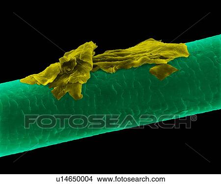 Picture - Human hair with dandruff, coloured scanning electron micrograph (SEM). The outer layer of hair (the cuticle) has overlapping scales of keratin. These scales are thought to prevent hairs from matting together. Hair is made up of a fibrous protein.... Fotosearch