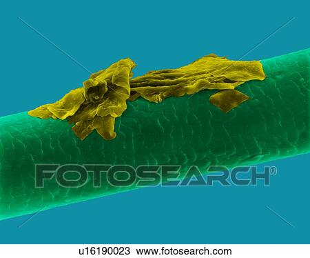 Human hair with dandruff, coloured scanning electron micrograph (SEM). The outer layer of hair (the cuticle) has overlapping scales of keratin. These scales are thought to prevent hairs from matting together. Hair is made up of a fibrous protein... View Large Photo Image Stock Image - Human hair with dandruff, coloured scanning electron micrograph (SEM). The outer layer of hair (the cuticle) has overlapping scales of keratin. These scales are thought to prevent hairs from matting together. Hair is made up of a fibrous protein.... Fotosearch