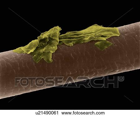 Stock Image - Human hair with dandruff, coloured scanning electron micrograph (SEM). The outer layer of hair (the cuticle) has overlapping scales of keratin. These scales are thought to prevent hairs from matting together. Hair is made up of a fibrous protein.... Fotosearch