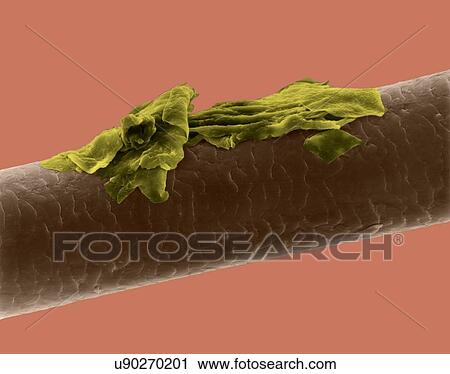 Human hair with dandruff, coloured scanning electron micrograph (SEM). The outer layer of hair (the cuticle) has overlapping scales of keratin. These scales are thought to prevent hairs from matting together. Hair is made up of a fibrous protein... View Large Photo Image Stock Image - Human hair with dandruff, coloured scanning electron micrograph (SEM). The outer layer of hair (the cuticle) has overlapping scales of keratin. These scales are thought to prevent hairs from matting together. Hair is made up of a fibrous protein.... Fotosearch