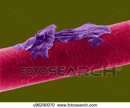 Stock Image - Human hair with dandruff, coloured scanning electron micrograph (SEM). The outer layer of hair (the cuticle) has overlapping scales of keratin. These scales are thought to prevent hairs from matting together. Hair is made up of a fibrous protein.... Fotosearch