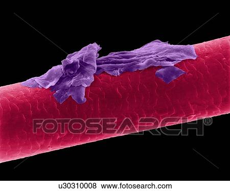 Human hair with dandruff, coloured scanning electron micrograph (SEM). The outer layer of hair (the cuticle) has overlapping scales of keratin. These scales are thought to prevent hairs from matting together. Hair is made up of a fibrous protein... View Large Photo Image Stock Photo - Human hair with dandruff, coloured scanning electron micrograph (SEM). The outer layer of hair (the cuticle) has overlapping scales of keratin. These scales are thought to prevent hairs from matting together. Hair is made up of a fibrous protein.... Fotosearch