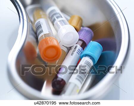 Stock Photography - Human medical samples including blood and urine in a kidney shaped bowl.. Fotosearch