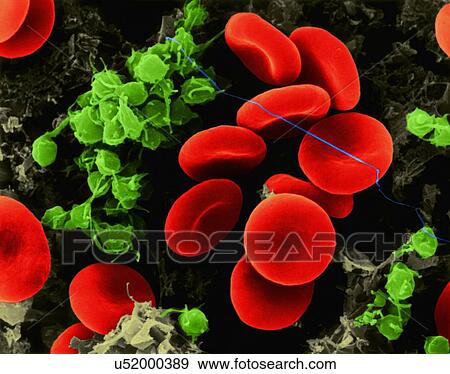 Stock Photo - Human red blood cells, activated platelets, and fibrin threads, coloured scanning electron micrograph (SEM). Human red blood cells (RBCs), or erythrocytes, are involved in delivering oxygen to the body tissue. The cytoplasm of RBCs is rich in.... Fotosearch
