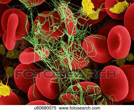 Stock Photography - Human red blood cells and activated platelets trapped in a fibrin blood clot, coloured scanning electron micrograph (SEM). Platelets in the blood are small oval disks and are termed nonactivated platelets or thrombocytes. Platelets serve as the body's.... Fotosearch