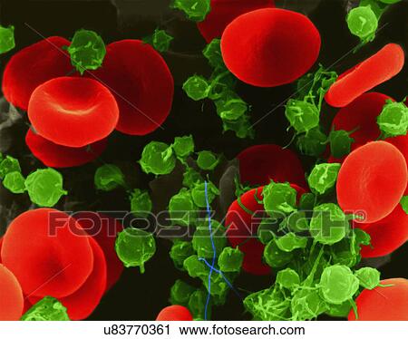 Human red blood cells and platelets, coloured scanning electron micrograph (SEM). Human red blood cells (RBCs), or erythrocytes, are involved in delivering oxygen to the body tissue. The cytoplasm of RBCs is rich in haemoglobin, an iron-containing... View Large Photo Image Stock Image - Human red blood cells and platelets, coloured scanning electron micrograph (SEM). Human red blood cells (RBCs), or erythrocytes, are involved in delivering oxygen to the body tissue. The cytoplasm of RBCs is rich in haemoglobin, an iron-containing.... Fotosearch