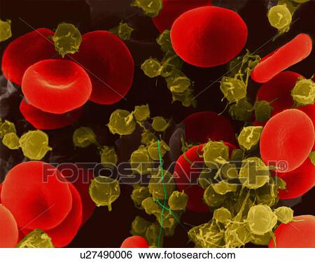 Stock Photograph - Human red blood cells and platelets, coloured scanning electron micrograph (SEM). Human red blood cells (RBCs), or erythrocytes, are involved in delivering oxygen to the body tissue. The cytoplasm of RBCs is rich in haemoglobin, an iron-containing.... Fotosearch