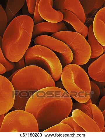 Stock Image - Human red blood cells, coloured scanning electron micrograph (SEM). Red blood cells (RBCs), or erythrocytes, are the most common type of blood cell in vertebrates. They are involved in delivering oxygen to the body tissue. RBCs take up oxygen in the.... Fotosearch